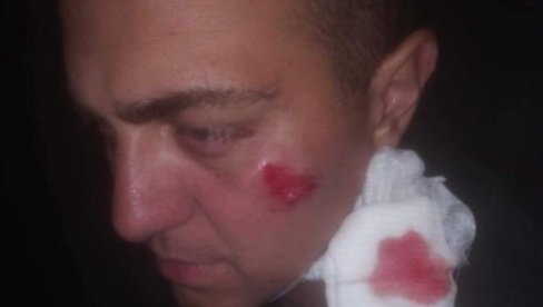 UZNEMIRUJUĆE: Pogledajte slike ranjenih policajaca koje su sinoć napali huligani (FOTO)