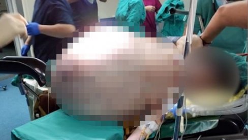 (UZNEMIRUJUĆI VIDEO) IZVADILI JOJ TUMOR OD 90 KILOGRAMA! Neverovatna operacija u Skoplju, najveći izmereni u Evropi