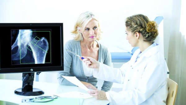 ОСТЕОПОРОЗА ПОГАЂА И МУШКАРЦЕ: Ако имате више од 50 године, обавезно проверавајте и здравље костију