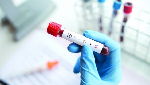 ПРОБОЈ У ИЗГРАДЊИ ИМУНИТЕТА НА ХИВ: За неутрализацију сојева овог вируса користе се нанотела из ДНК ламе