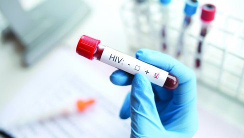 ŠEST PACIJENATA U BRAZILU DOBILO HIV VIRUS: Organi za transplataciju su se pokazali pozitivni na test