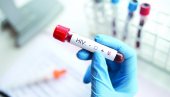 PROBOJ U IZGRADNJI IMUNITETA NA HIV: Za neutralizaciju sojeva ovog virusa koriste se nanotela iz DNK lame