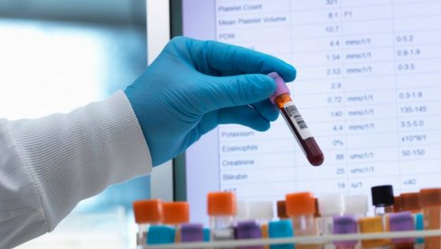 VELIKO OTKRIĆE NAUČNIKA: Novi test krvi otkriva više od 50 vrsta raka i obećava raniju dijagnozu