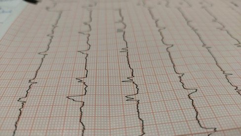 ДОПЛЕР КАРОТИДЕ И ЕКГ: Бесптани прегледи у суботу, пријављивање почело данас