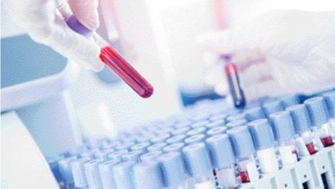 HEMATOLOGIJA: Od raka krvi oboli 500 ljudi godišnje HEMATOLOGIJA: Od raka krvi oboli 500 ljudi godišnje