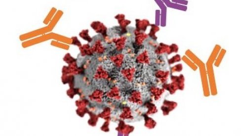 U VOJVODINI 273, A U NOVOM SADU 32 NOVOZARAŽENA: Institut za javno zdravlje Vojvodine o epidemiološkoj situaciji U VOJVODINI 273, A U NOVOM SADU 32 NOVOZARAŽENA: Institut za javno zdravlje Vojvodine o epidemiološkoj situaciji