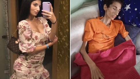SANELI PONESTAJE VREMENA: Posle tri godine teške borbe, lek iz inostranstva poslednja nada SANELI PONESTAJE VREMENA: Posle tri godine teške borbe, lek iz inostranstva poslednja nada
