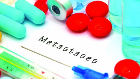 DA LI JE OVO PREKRETNICA U LEČENJU KARCINOMA: Analiza bazne membrane ćelija pomoći će u ranom otkrivanju metastaza?