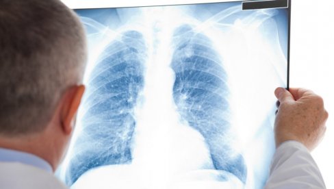 VAŽNA VEST ZA GRAĐANE: Od jeseni počinje skrining na rano otkrivanje raka pluća u Beogradu
