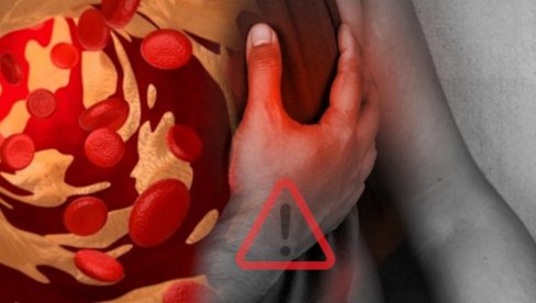 REAGUJTE NA VREME: Simptom infarkta koji mnogi ignorišu