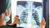 SKRINING NA RANO OTKRIVANJE RAKA PLUĆA: Prošlo više od 2.200 građana u riziku SKRINING NA RANO OTKRIVANJE RAKA PLUĆA: Prošlo više od 2.200 građana u riziku