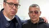 VUČIĆ OBIŠAO POLICAJCA POVREĐENOG ISPRED RTS: Zadobio je teške telesne povrede. Jezive. Udarili su ga bokserom