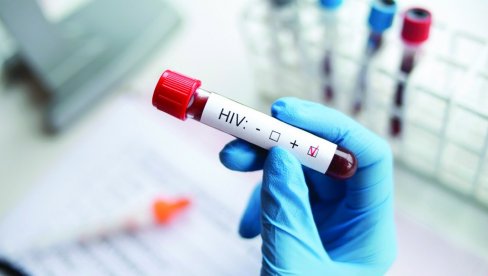 NEMERLJIV=NEZARAZAN: Istina o HIV koju svi treba da znaju