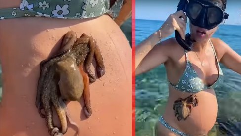 VRIŠTALA: Trudnica se kupala u moru, za stomak joj se zakačila HOBOTNICA (VIDEO)