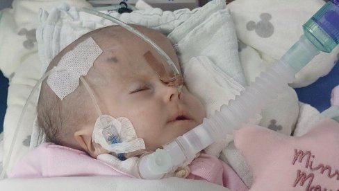 ЗА НИКОЛИЈУ СВАКИ УДАХ ВЕЛИКА БОРБА: Осмомесечна девојчица из Силбаша има тежак генетски поремећај, за кућно лечење треба 1.500 евра месечно ЗА НИКОЛИЈУ СВАКИ УДАХ ВЕЛИКА БОРБА: Осмомесечна девојчица из Силбаша има тежак генетски поремећај, за кућно лечење треба 1.500 евра месечно