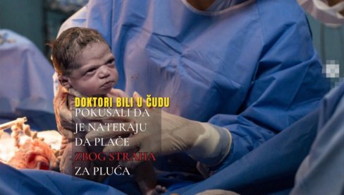 O BESNOJ BEBI PRIČAO SVET - VIDITE JE SAD: Doktori bili u čudu - pokušali da je rasplaču, da vide rade li joj pluća (FOTO) O BESNOJ BEBI PRIČAO SVET - VIDITE JE SAD: Doktori bili u čudu - pokušali da je rasplaču, da vide rade li joj pluća (FOTO)