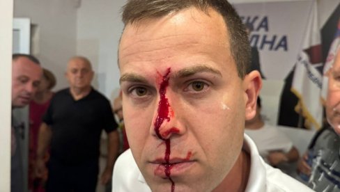 BLOKADERI ČOVEKU RASKRVARILI GLAVU: Jezivo nasilje u Lazarevcu (FOTO) BLOKADERI ČOVEKU RASKRVARILI GLAVU: Jezivo nasilje u Lazarevcu (FOTO)