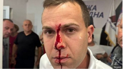 ПОВРЕЂЕНА ТРИ ЧЛАНА СНС: Огласио се Општински одбор у Лазаревцу поводом језивог насиља блокадера ПОВРЕЂЕНА ТРИ ЧЛАНА СНС: Огласио се Општински одбор у Лазаревцу поводом језивог насиља блокадера