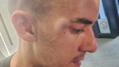 УХАПШЕН НАПАДАЧ НА ЕКИПУ ИНФОРМЕРА: Брутално напао новинара и камермана