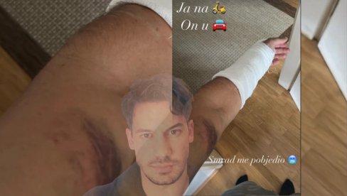 ГЛУМАЦ НАСТРАДАО Петар сав у модрицама, рука у гипсу: Смрад ме победио! (ФОТО) ГЛУМАЦ НАСТРАДАО Петар сав у модрицама, рука у гипсу: Смрад ме победио! (ФОТО)