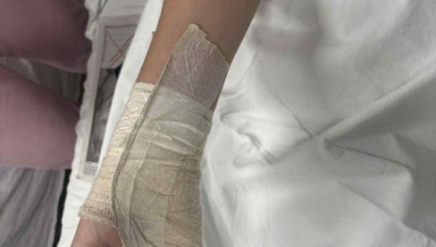 DEČAKU (14) IZ NIŠA AMPUTIRAN DEO PRSTA: Majka tvrdi da su ga šipkom pretukla četvorica maloletnika DEČAKU (14) IZ NIŠA AMPUTIRAN DEO PRSTA: Majka tvrdi da su ga šipkom pretukla četvorica maloletnika