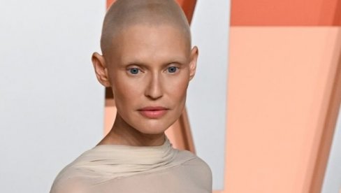 LEPOTICA SE BORILA SE SA RAKOM, VICTORIAS SECRET JE ODBILA ZA REVIJU, A ONDA IH JE JAVNO POSRAMILA PISMOM: Nisam najmlađa, nemam najlepše