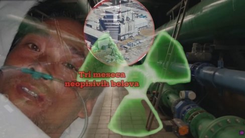 NAJBOLNIJA SMRT U ISTORIJI: Plakao krv posle nuklearne katastrofe, molio doktore da ga puste da umre - TRI MESECA agonije