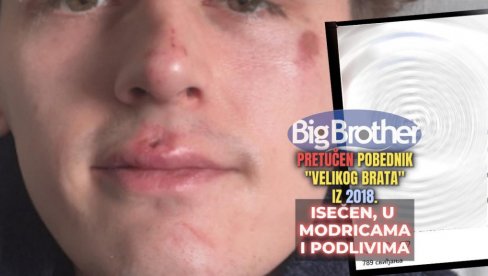 БРУТАЛНО ПРЕТУЧЕН ПОБЕДНИК ВЕЛИКОГ БРАТА Политика, влада, људи — желе да нас поделе, али они неће победити БРУТАЛНО ПРЕТУЧЕН ПОБЕДНИК ВЕЛИКОГ БРАТА Политика, влада, људи — желе да нас поделе, али они неће победити