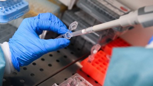 ODOBRENA VAKCINA ZA LEČENJE MELANOMA: Ministarstvo zdravlja Rusije donelo odluku