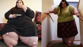 IMALA SKORO 300 KG, NIJE MOGLA DA HODA: Danas igleda sjajno - a na intenetu je prati više od 400 hiljada ljudi! (FOTO)