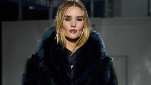 ЗАШТО ЦЕО СВЕТ ПРИЧА О РОУЗ ХАНТИНГТОН-ВАЈТЛИ? Овако изгледа лице жене која је себе уништила прераним и непотребним ботоксом!