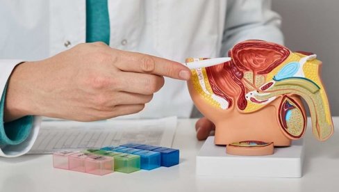 Za adenom prostate laserska hirurgija Tulijumom od 200 vati  rešenje je bez kompromisa