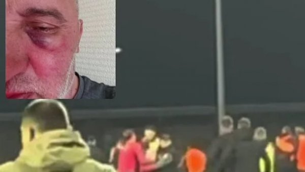 СКАНДАЛ ТРЕСЕ РЕГИОН! Фудбалери Жељезничара брутално претукли фотографа Слоге