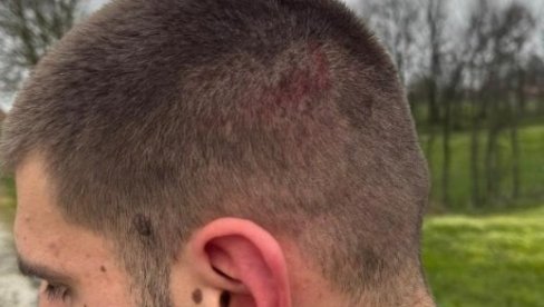 PALICE, BIBER SPREJ, MUNICIJA... Privedeni napadači na Vukašina Đokovića - NJih petnaestorica, evo šta su sve imali kod sebe