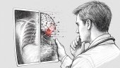 ВЕШТАЧКА ИНТЕЛИГЕНЦИЈА У МЕДИЦИНИ: Наш савезник, не замена