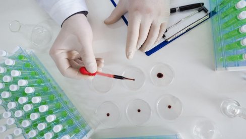 БАТУТ СЕ ХИТНО ОГЛАСИО ПОВОДОМ СМРТОНОСНОГ ХАНТАВИРУСА: Ево какво је за сада стање у Србији