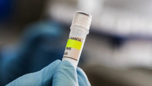 РУСКИ ЕПИДЕМИОЛОГ: Вакцина против хантавируса могућа, али регистрација траје неколико година
