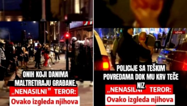 САВ КРВАВ НАКОН НАПАДА РАЗУЛАРЕНЕ МАСЕ: Блокадери унаказали полицајца јер ради свој посао