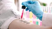 ALERGIJE SE POJAVLJUJU I U ZRELIM GODINAMA Savet stručnjaka: Prvo uradite kožne testove, pa antigen iz krvi