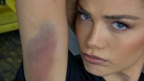 CELO TELO U PODLIVIMA: Milica Pavlović se povredila na snimanju spotova za novi album Caka (FOTO)