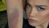 CELO TELO U PODLIVIMA: Milica Pavlović se povredila na snimanju spotova za novi album Caka (FOTO)